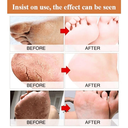 Foot Cream for Cracked and Dry Skin, Heel, Finger Healing Balm and Blaster 200 ml.